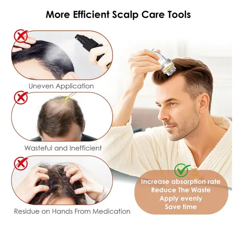 Dapeng Aplicador De Minoxidil Y Sérum Capilar Para Cuero Cab