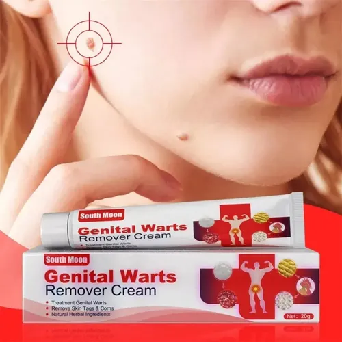 Cc 3uds*pomada Para Eliminar Las Verrugas Del Herpes