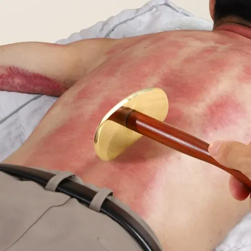 Tabla Gua Sha De Bronce Con Mango Largo Para Masajes