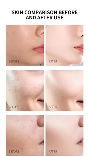 Kojic Acid Turmeric Niacinamide Serum For Brightening 30ml