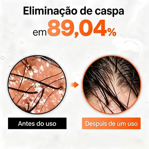Sérum Crecimiento Capilar Lilyeve Con Aplicador
