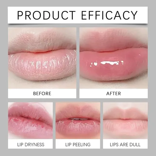 M* Decream Lip Belain Fordyce, Alivia La Sequedad * Xlbo