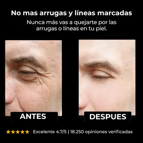 (x 4) Crema Facial Antiage Para Hombre Omen 50 Ml