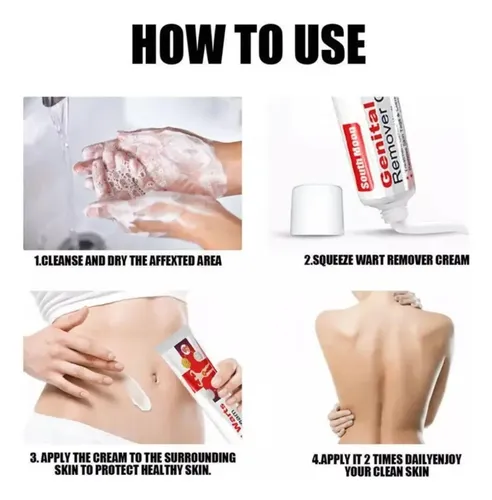 Cc 3uds*pomada Para Eliminar Las Verrugas Del Herpes
