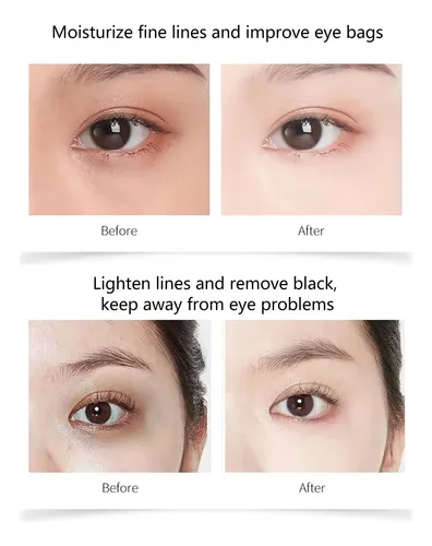 Crema Hidratante Reafirmante Para Ojos Con Retinoato Madura Día/noche