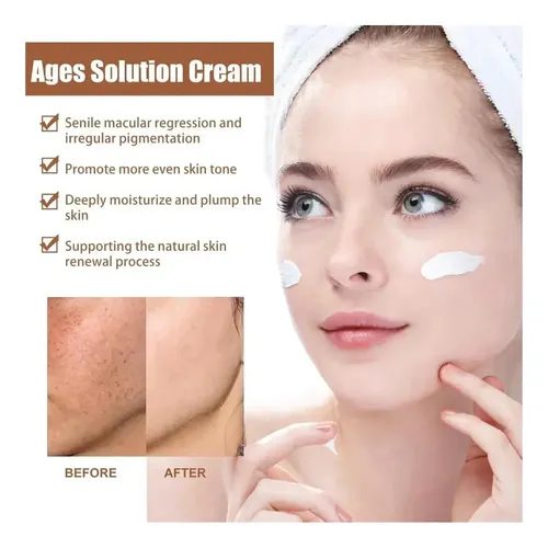 +crema Para Manchas Oscuras En La Cara, Cremas Para Quitar /