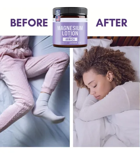 Crema Nocturna De Magnesio Para Músculos Y Articulaciones