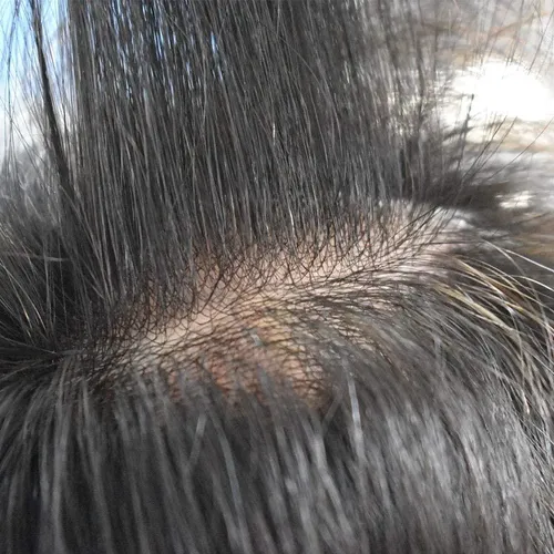 Peluquin De Pelo Humano Fino Para Hombre 8×10 Jet Black