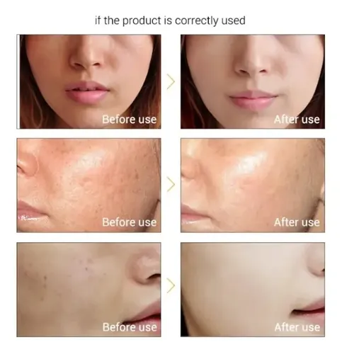 Serum Lanbena Vitamina C Remueve Pecas Y Manchas 15ml Full
