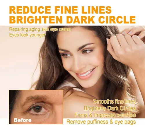 Crema Reparadora De Ojos 5d E Anting King 15 Ml
