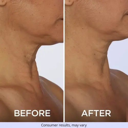 .sa Crema Reafirmante De Cuello Gopure Sj 2566031842005 .hg