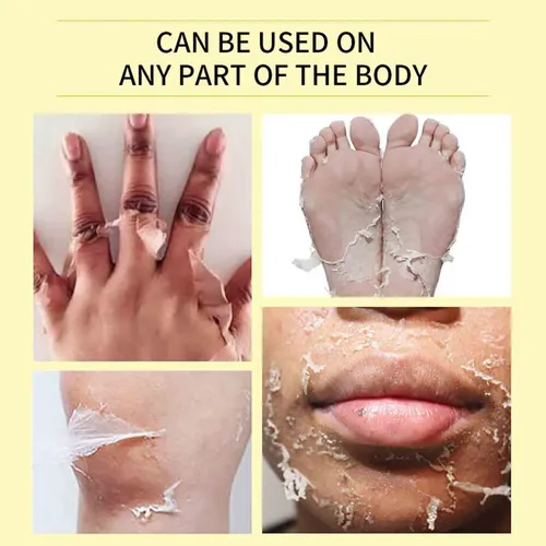 Aceite Exfoliante Amarillo Gextra Strength Para Blanquear La Piel