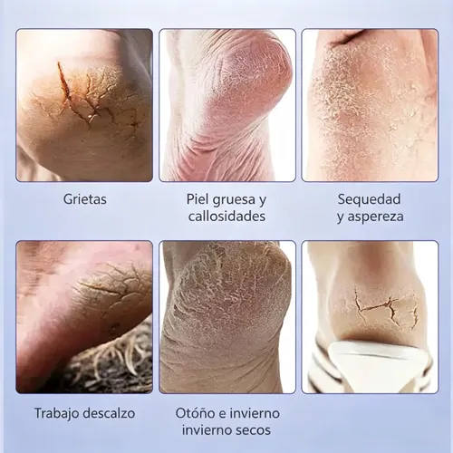 Crema Reparadora De Pies, 20 G, Hidratante Para Pies Secos Y