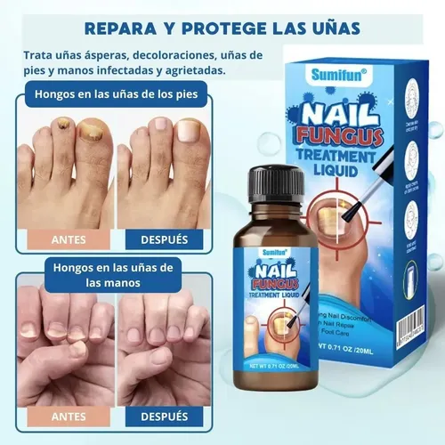 Laca Uña Manos Pies Cura Hongo + Suero Reparador Profesional Fragancia Neutra