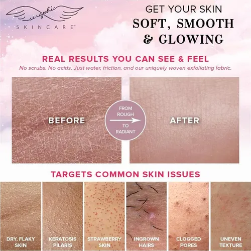 Guante Exfoliante Premium Coreano Seraphic Summer Glow 1ud