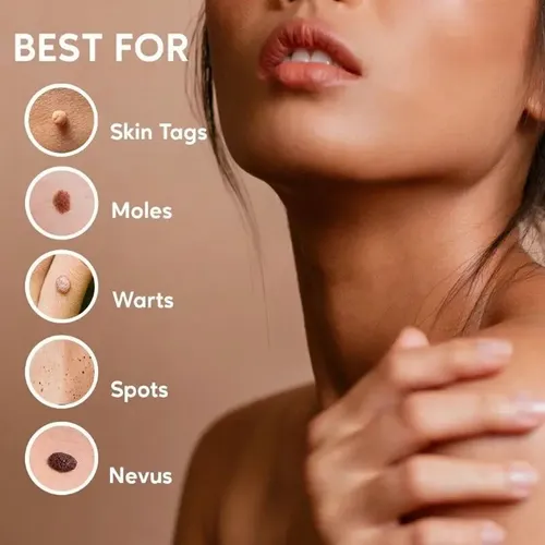 Crema Para La Eliminación Instantánea De Manchas Removedor