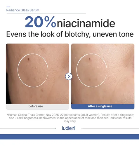 Sérum Radiance Glass Serum Con 20% De Niacinamida Para El Cu Todo Tipo De Piel Día/noche