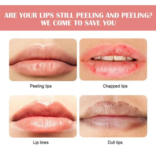 Mascarilla Labial Compacta Con Sabor A Sandía Hoygi: .