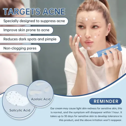 Crema Azelaico 14% Niacinamida Y C, Calmante 30 Ml ^.^