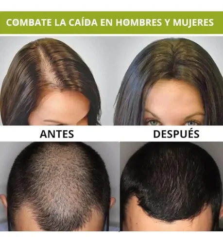 Serum Crecimiento Fortalecedor Engrosador Cabello Quvek 30ml