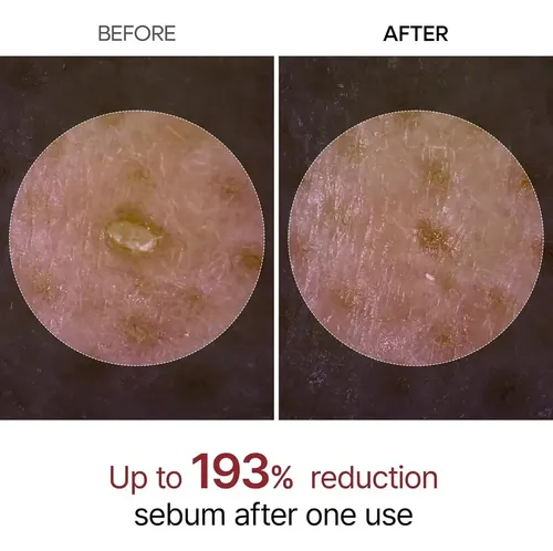 Jd Dr. Melaxin Official Rice Peel Shotglor1 Ampolla Dúo