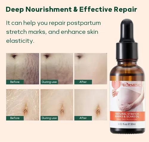 Aceite Corporal Hidratante Para Piel Normal, Cuidado Corpora Essential Oil
