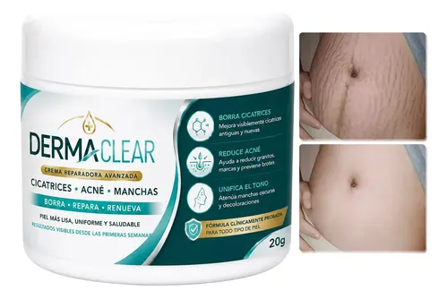 Crema Reparadora Acné Cicatrices Varices Estrías 20 G Tópica