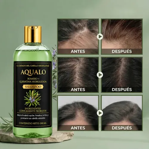 Shampoo Aqualo Pack 6 Meses Crecimiento Y Menos Caída