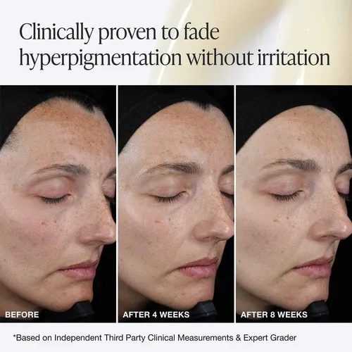 Innbeauty Project C Serum Facial 15% Vitamina C + Ácido Ferú
