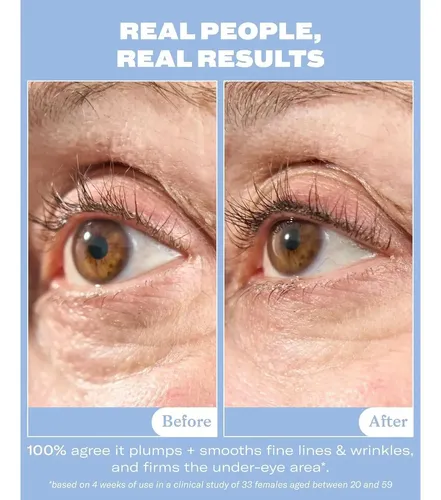 Crema para Ojos con Mucina de Caracol Then I Met You, para Piel Sensible y Alisado de Arrugas