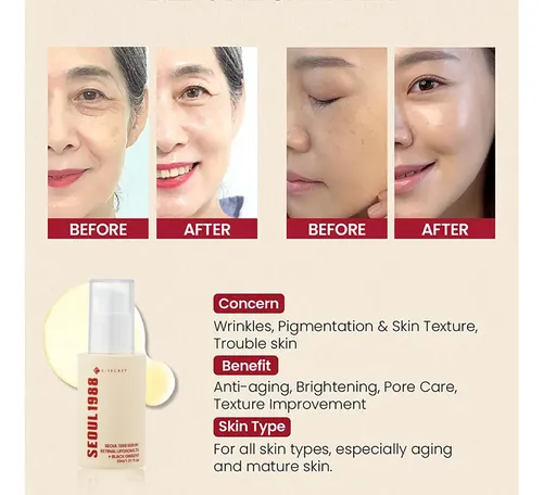 Serum Facial Retinal Liposomas 30ml Seoul 1988 Todo Tipo De Piel Día/noche