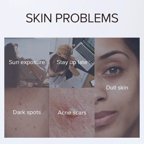 Crema De Noche Laikou Antimanchas Y Pecas – Niacinamida
