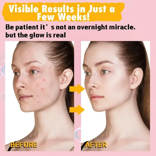 Jabón Facial Y Corporal Urrznp Cúrcuma Limón 2 Unidades