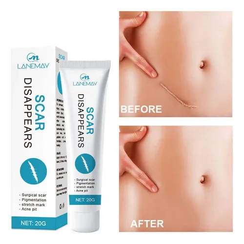 – Gel Eliminador De Cicatrices Go For Queloides, Crema
