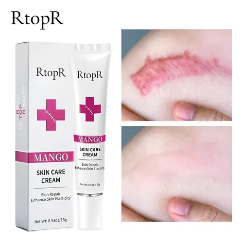Gel Para Cicatrices Manchas Quemaduras Estrias Acne Crema
