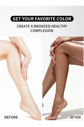 Corrector De Piernas O’cheal: Adiós A Varices Y Manchas –