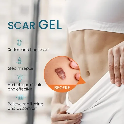 C De Crema Para Eliminar Cicatrices, Gel Avanzado Para Y