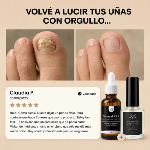 Aceite Antihongos Manos 10 Cc Y Pies 30cc Natural Vya Neutra