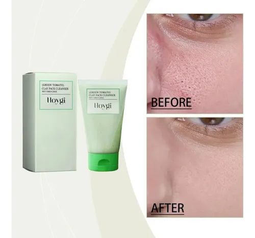 Mascarilla Facial De Arcilla, Mascarilla De Tomate Verde2025