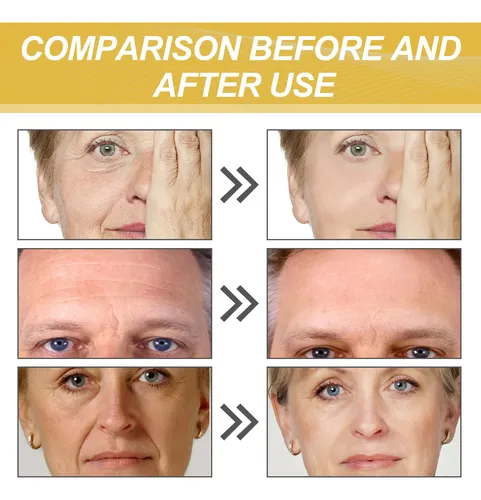 Mascarilla De Colágeno Eelhoe, Mascarilla Hidratante Con Pro