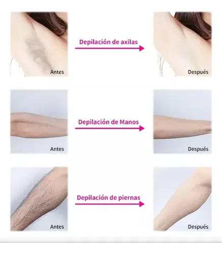 Portátil De Moda Depiladora Eléctrica Depiladora Facial