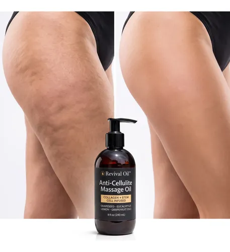 Anticelulítico Reductor Aceite Revival Oil 240ml Pack X2