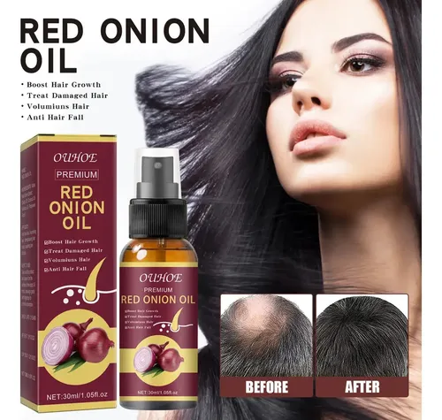 Caceite De Cebolla Para El Crecimiento Del Cabello 2pz .