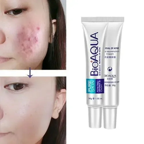Crema Bioaqua Acné Bioaqua Pure Skin día/noche para piel normal de 30mL/30g 20+ años