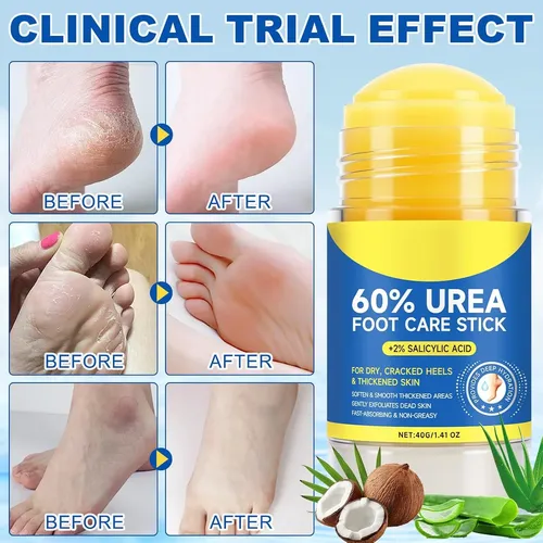 Crema Para Pies En Barra Con 60% De Urea, 2% De Ácido Salicílico,