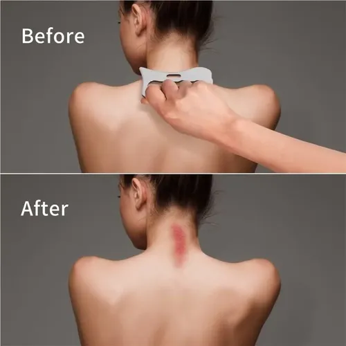 Placa Gua Sha Acero Inoxidable Alivio Dolor Masaje Relajante Plateado