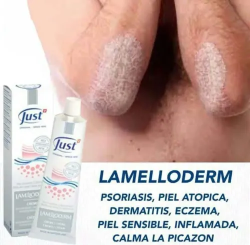 Crema Lamelloderm Con Cardiospermum Y Regaliz – Just – Psoriasis
