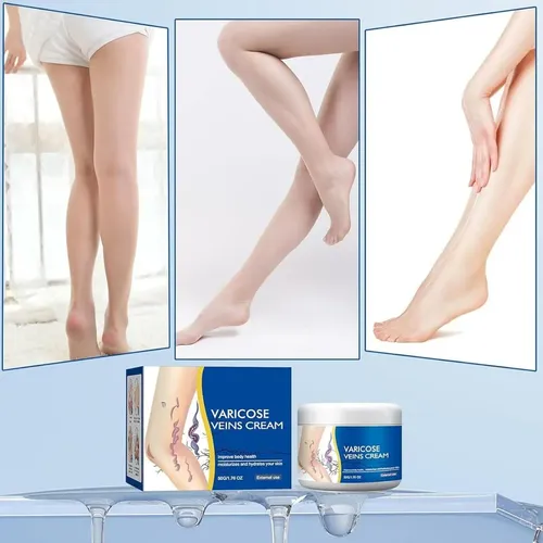 D Crema Reparadora De Piernas Para Venas Varicosas, Crema
