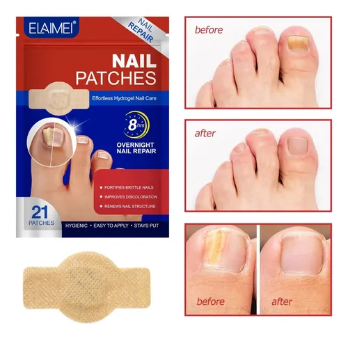 Parches Elaimei Para Reparación De Uñas De Los Pí Caqui