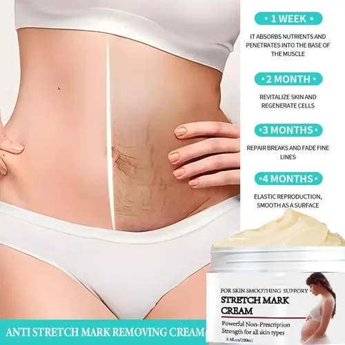 Crema Para Estrías Y Crema Para La Barriga Durante El Embarazo